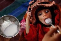 Pungutan Rp.1,3 Juta Untuk Program Penanggulangan Stunting di Jaksel Misterius