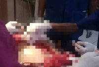 Tragis! Dua Remaja Mengalami Serangan Senjata Tajam Saat Mengarak Bedug di Rengasdengklok