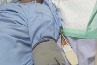 Diduga Lakukan Kelalaian Pasca Operasi Tempurung Kepala Pasien Sempat Hilang,Keluarga Pasien : Minta Pertanggung Jawaban RSUD ULIN  Banjarmasin